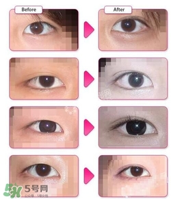 哪些人需要開眼角？需要開眼角的眼睛圖片