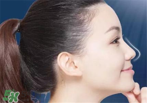 隆鼻會(huì)拉近眼距嗎？隆鼻會(huì)改變眼睛嗎？