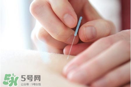 沒病可以針灸嗎？沒病可以扎針嗎？