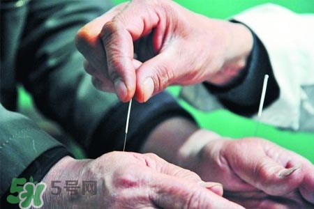 沒病可以針灸嗎？沒病可以扎針嗎？