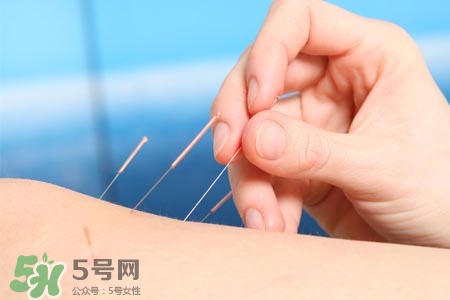 沒病可以針灸嗎？沒病可以扎針嗎？