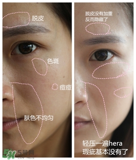赫拉氣墊用了悶痘嗎？赫拉氣墊悶痘怎么辦？