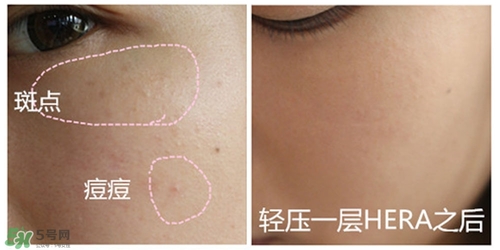 赫拉氣墊用了悶痘嗎？赫拉氣墊悶痘怎么辦？