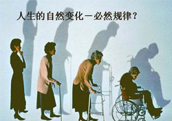 哪些人容易得骨質(zhì)疏松癥？骨質(zhì)疏松的高發(fā)人群有哪些？