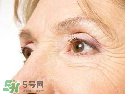 老年斑是怎么形成的？老年斑的形成原因