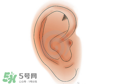 中耳炎有什么癥狀？中耳炎的癥狀表現(xiàn)