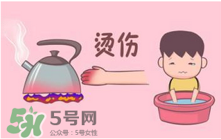 燙傷可以用牙膏嗎？燙傷用牙膏管用嗎？