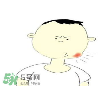 嘴角起泡是什么原因？嘴角起泡怎么辦？