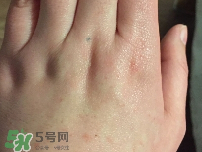 薇諾娜適合什么皮膚？薇諾娜適合敏感肌嗎？