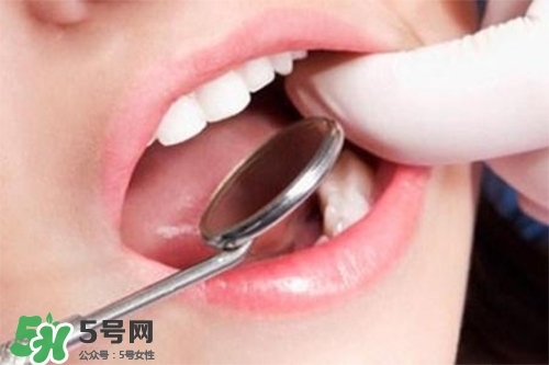 口腔異味是怎么回事？口腔異味怎么清除？