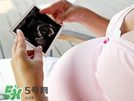 保胎期間可以洗澡嗎？臥床保胎可以洗澡嗎？