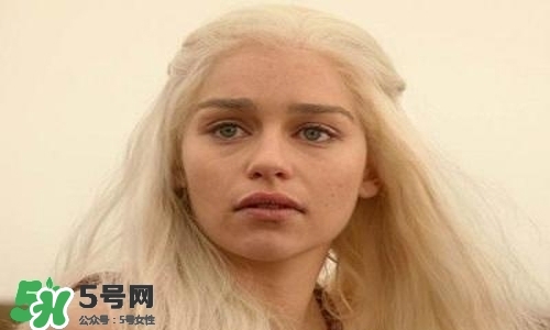 臉色發(fā)黃是什么原因？臉色發(fā)黃吃什么調(diào)理更好？