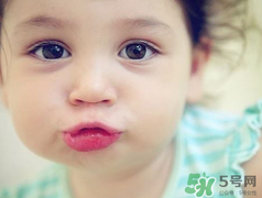 孕期可以激光祛斑嗎？懷孕了能做激光祛斑嗎？