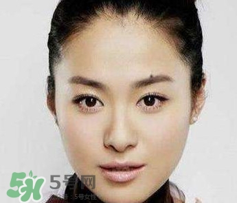 如何預(yù)防臉上長痣？怎樣預(yù)防臉上長痣