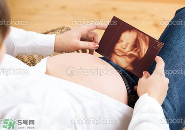橄欖油真的可以預(yù)防妊娠紋嗎？橄欖油真的可以去妊娠紋嗎？