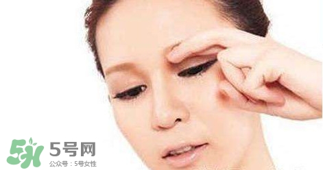 怎樣祛除眼底細紋？如何去除眼底細紋