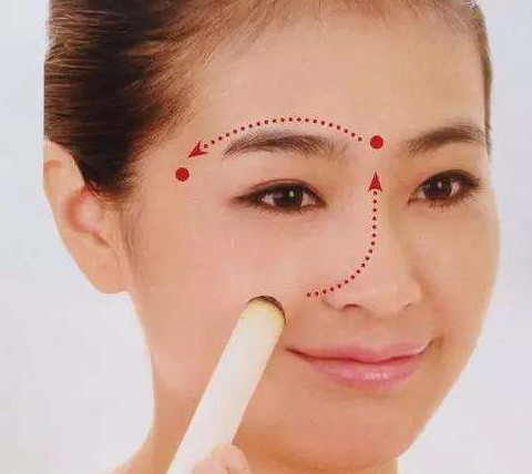 艾灸可以去黑眼圈嗎？艾灸可不可以去黑眼圈