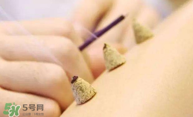 剛懷孕可以艾灸嗎？剛懷孕可以艾灸腹部嗎