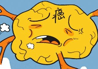 胃癌是怎么引起的？胃癌的早起癥狀