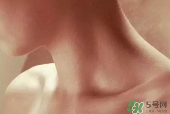 頸椎老化是什么??？頸椎老化的癥狀