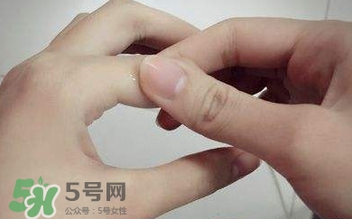痛風(fēng)有什么癥狀？女性痛風(fēng)的初期癥狀