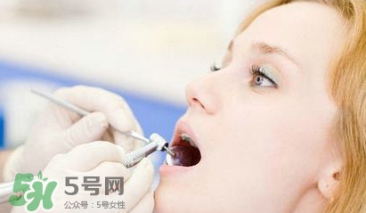 牙齒松動能自己恢復嗎？牙齒松動會自己恢復嗎