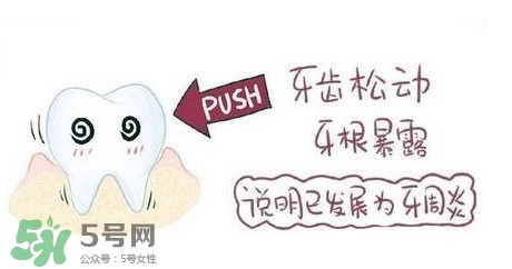 牙齒松動能自己恢復嗎？牙齒松動會自己恢復嗎