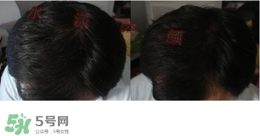  資生堂不老林洗發(fā)水怎么樣？資生堂不老林洗發(fā)水能長(zhǎng)頭發(fā)嗎