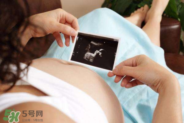 四維彩超能看出男女嗎？四維彩超能看清手指嗎？