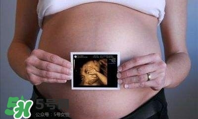 四維彩超能看出男女嗎？四維彩超能看清手指嗎？