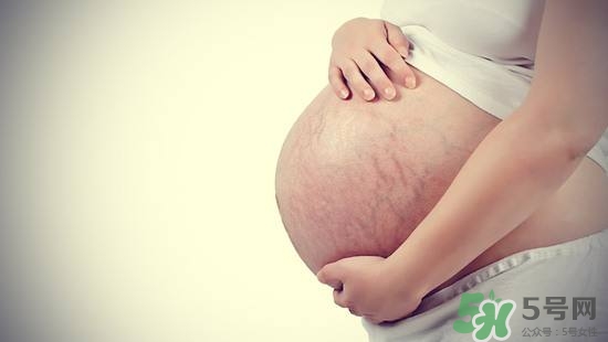妊娠紋什么時候長出來？哪種皮膚容易長妊娠紋？