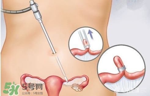 女人怎樣避孕最安全？對(duì)女人最好的避孕方法