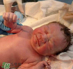 新生兒手握避孕環(huán)出生是怎么回事？出生后健康嗎？