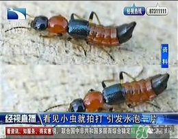 隱翅蟲(chóng)有毒嗎？隱翅蟲(chóng)會(huì)毀容嗎？