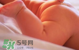 寶寶尿布疹可以擦紅霉素軟膏嗎？紅霉素軟膏對(duì)尿布疹有效嗎？
