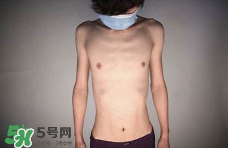 HIV真有這么可怕嗎？艾滋病的臨床表現(xiàn)主要有哪些