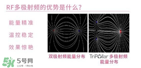 tripollar stop怎么樣？tripollar pose好用嗎
