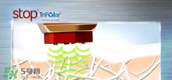 tripollar stop怎么樣？tripollar pose好用嗎