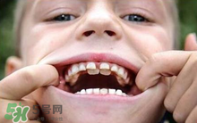 兒童換牙可以吃鈣片嗎?兒童換牙吃什么好？