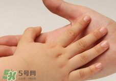 寶寶指甲凹凸不平是什么原因？寶寶指甲凹凸不平正常嗎？