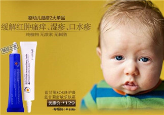 恩姆花園濕疹膏有激素嗎？恩姆花園濕疹膏含不含激素？