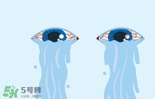 眼藥水可以兩個人用嗎？眼藥水可以共用嗎？