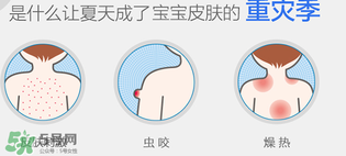 妙思樂爽膚水好用嗎？妙思樂爽膚水能去痱嗎？