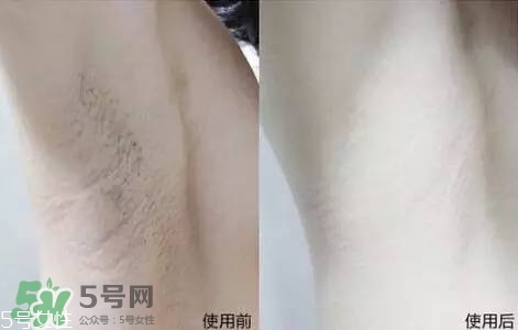 nair脫毛膏評測？nair脫毛膏保質(zhì)期