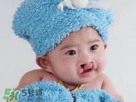 兔唇可以治嗎？兔唇修補術