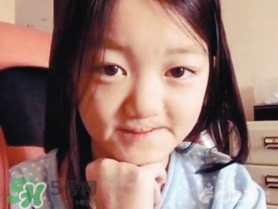 兔唇是什么？兔唇是什么原因造成的？