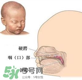 兔唇能檢查出來(lái)嗎？兔唇能完全修復(fù)嗎？
