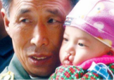 兔唇是什么？兔唇是什么原因造成的？