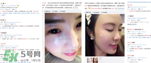 天倍面膜是日本的嗎？日本tenbe天倍面膜騙局