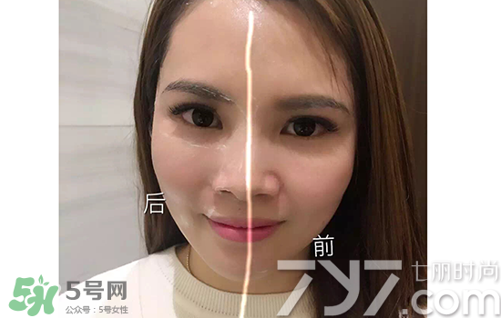黃金棒有什么用？黃金棒的功效與作用